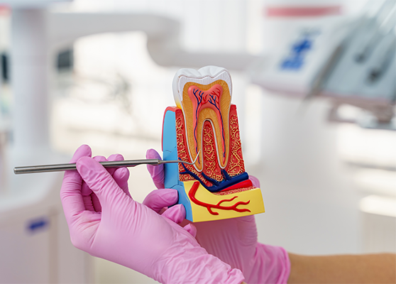 ENDODONCIA EN GUAYAQUIL ECUADOR ECONOMICO